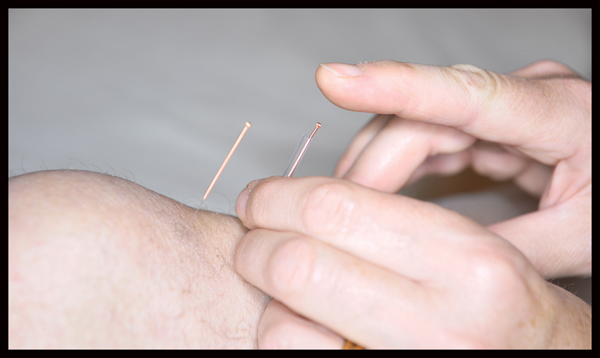 Acupuncture of the knee